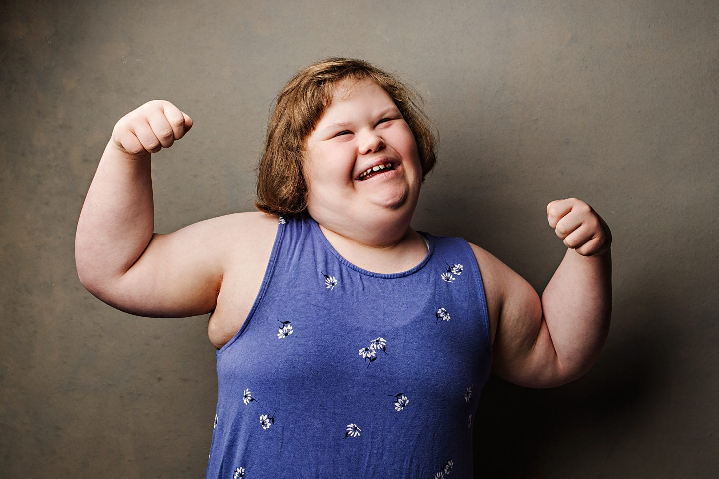 Photo essay challenges Down syndrome stereotypes | Broadview Magazine