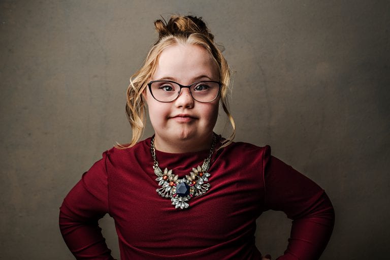 Photo essay challenges Down syndrome stereotypes | Broadview Magazine